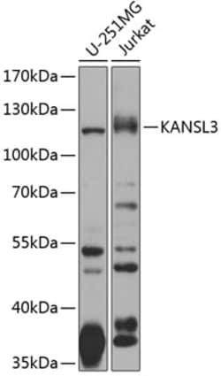 Invitrogen KIAA1310 Polyclonal Antibody 100 &mu;L; Unconjugated:Antibodies,
