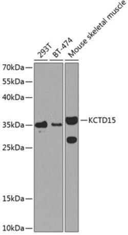 Invitrogen KCTD15 Polyclonal Antibody 100 &mu;L; Unconjugated:Antibodies,