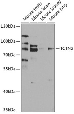 Invitrogen TCTN2 Polyclonal Antibody 100 &mu;L | Buy Online | Invitrogen&trade; | Fisher Scientific