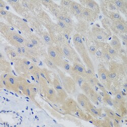 Invitrogen Securin Polyclonal Antibody 100 &mu;L | Buy Online | Invitrogen&trade; | Fisher Scientific