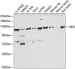 Invitrogen SIK2 Polyclonal Antibody 100 &mu;L; Unconjugated:Antibodies,