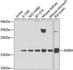 Invitrogen NME4 Polyclonal Antibody 100 &mu;L | Buy Online | Invitrogen&trade; | Fisher Scientific