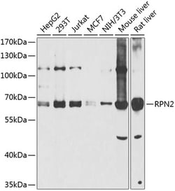 Invitrogen Ribophorin II Polyclonal Antibody 100 &mu;L; Unconjugated:Antibodies,