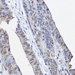 Invitrogen XPC Polyclonal Antibody 100 &mu;L; Unconjugated:Antibodies,