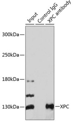 Invitrogen XPC Polyclonal Antibody 100 &mu;L; Unconjugated:Antibodies,