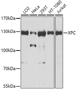 Invitrogen XPC Polyclonal Antibody 100 &mu;L; Unconjugated:Antibodies,
