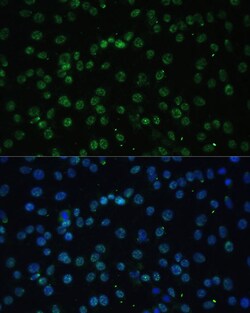 Invitrogen UAP56 Polyclonal Antibody 100 &mu;L; Unconjugated:Antibodies,