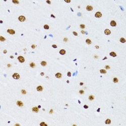 Invitrogen UAP56 Polyclonal Antibody 100 &mu;L; Unconjugated:Antibodies,