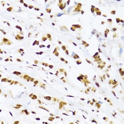 Invitrogen UAP56 Polyclonal Antibody 100 &mu;L; Unconjugated:Antibodies,
