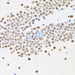 Invitrogen UAP56 Polyclonal Antibody 100 &mu;L; Unconjugated:Antibodies,