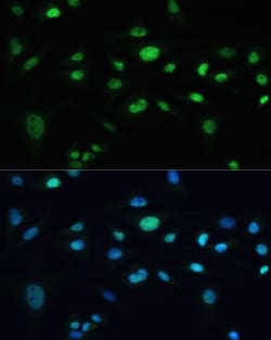 Invitrogen MDC1 Polyclonal Antibody 100 &mu;L; Unconjugated:Antibodies,