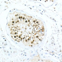 Invitrogen MDC1 Polyclonal Antibody 100 &mu;L; Unconjugated:Antibodies,
