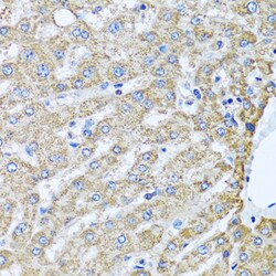 Invitrogen TMEM189 Polyclonal Antibody 100 &mu;L; Unconjugated:Antibodies,