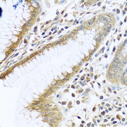 Invitrogen TMEM189 Polyclonal Antibody 100 &mu;L; Unconjugated:Antibodies,