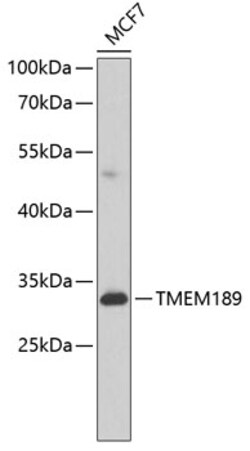 Invitrogen TMEM189 Polyclonal Antibody 100 &mu;L; Unconjugated:Antibodies,