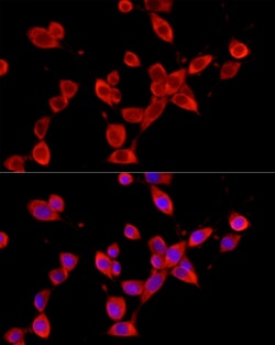 Invitrogen YTHDF3 Polyclonal Antibody 100 &mu;L; Unconjugated:Antibodies,