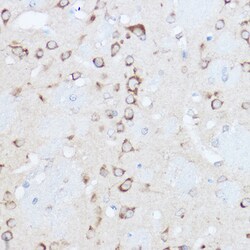 Invitrogen YTHDF3 Polyclonal Antibody 100 &mu;L; Unconjugated:Antibodies,
