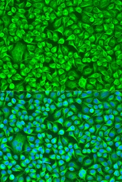 Invitrogen TUBB8 Polyclonal Antibody 100 &mu;L; Unconjugated:Antibodies,