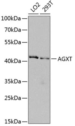 Invitrogen AGXT Polyclonal Antibody 100 &mu;L; Unconjugated:Antibodies,