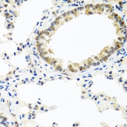 Invitrogen BMP5 Polyclonal Antibody 100 &mu;L; Unconjugated:Antibodies,