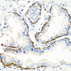 Invitrogen BMP5 Polyclonal Antibody 100 &mu;L; Unconjugated:Antibodies,