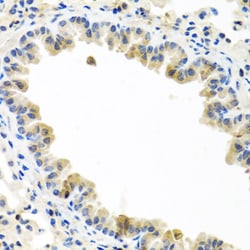 Invitrogen BMP5 Polyclonal Antibody 100 &mu;L; Unconjugated:Antibodies,