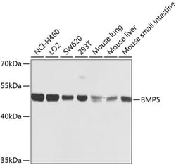 Invitrogen BMP5 Polyclonal Antibody 100 &mu;L; Unconjugated:Antibodies,