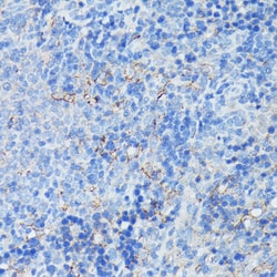 Invitrogen CD21 Polyclonal Antibody 100 &mu;L | Buy Online | Invitrogen&trade; | Fisher Scientific