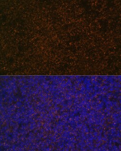 Invitrogen CD21 Polyclonal Antibody 100 &mu;L | Buy Online | Invitrogen&trade; | Fisher Scientific