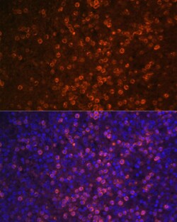 Invitrogen CD21 Polyclonal Antibody 100 &mu;L | Buy Online | Invitrogen&trade; | Fisher Scientific
