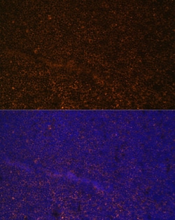 Invitrogen CD21 Polyclonal Antibody 100 &mu;L | Buy Online | Invitrogen&trade; | Fisher Scientific