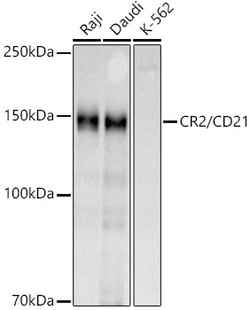 Invitrogen CD21 Polyclonal Antibody 100 &mu;L | Buy Online | Invitrogen&trade; | Fisher Scientific