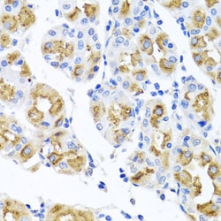 Invitrogen FECH Polyclonal Antibody 100 &mu;L; Unconjugated:Antibodies,