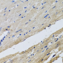 Invitrogen FECH Polyclonal Antibody 100 &mu;L; Unconjugated:Antibodies,