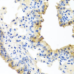 Invitrogen FECH Polyclonal Antibody 100 &mu;L; Unconjugated:Antibodies,