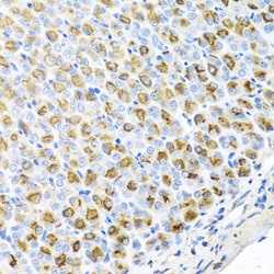 Invitrogen FECH Polyclonal Antibody 100 &mu;L; Unconjugated:Antibodies,