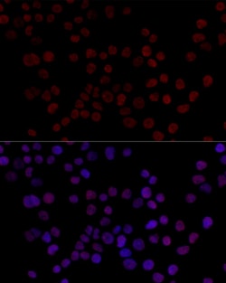 Invitrogen hnRNP L Polyclonal Antibody 100 &mu;L; Unconjugated:Antibodies,