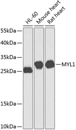 Invitrogen MYL1 Polyclonal Antibody 100 &mu;L; Unconjugated:Antibodies,