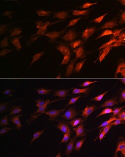 Invitrogen NF-H Polyclonal Antibody 100 &mu;L | Buy Online | Invitrogen&trade; | Fisher Scientific
