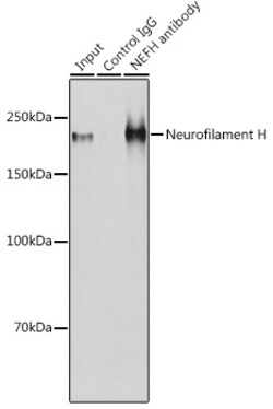 Invitrogen NF-H Polyclonal Antibody 100 &mu;L | Buy Online | Invitrogen&trade; | Fisher Scientific