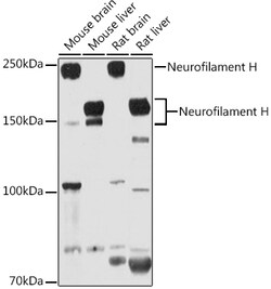 Invitrogen NF-H Polyclonal Antibody 100 &mu;L | Buy Online | Invitrogen&trade; | Fisher Scientific