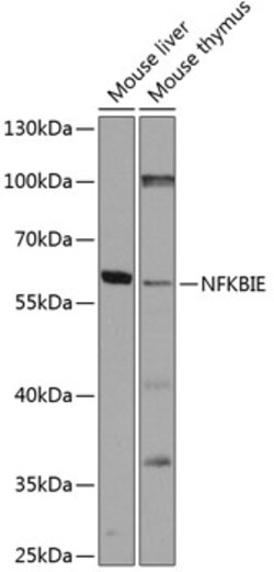 Invitrogen IkB epsilon Polyclonal Antibody 100 &mu;L | Buy Online | Invitrogen&trade; | Fisher Scientific