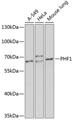 Invitrogen PHF1 Polyclonal Antibody 100 &mu;L; Unconjugated:Antibodies,