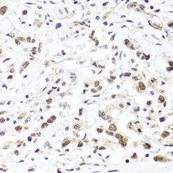 Invitrogen HIRA Polyclonal Antibody 100 &mu;L; Unconjugated:Antibodies,