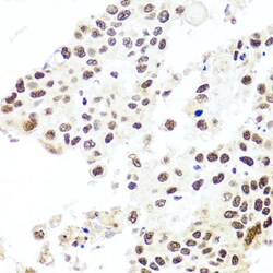 Invitrogen HIRA Polyclonal Antibody 100 &mu;L; Unconjugated:Antibodies,