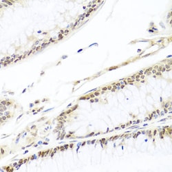 Invitrogen HIRA Polyclonal Antibody 100 &mu;L; Unconjugated:Antibodies,