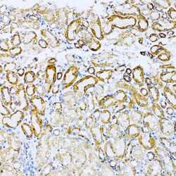 Invitrogen UVRAG Polyclonal Antibody 100 &mu;L; Unconjugated:Antibodies,