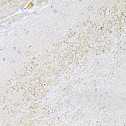 Invitrogen UVRAG Polyclonal Antibody 100 &mu;L; Unconjugated:Antibodies,