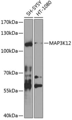 Invitrogen ZPK Polyclonal Antibody 100 &mu;L; Unconjugated:Antibodies,