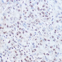 Invitrogen TAF15 Polyclonal Antibody 100 &mu;L; Unconjugated:Antibodies,